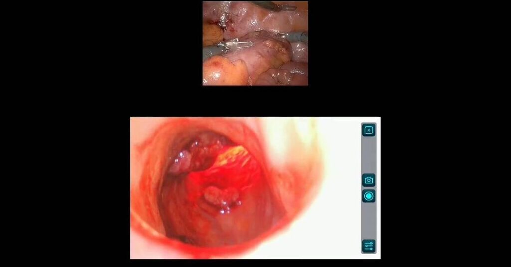 Images from the Lumeneye system in surgery