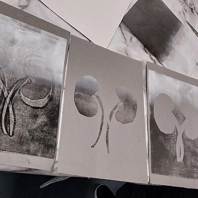 Young adult renal patient artwork developed as part of creative workshops