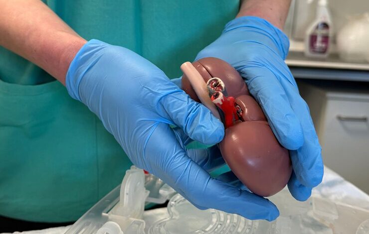 nhs staff wearing blue gloves holding an artificial kidney