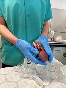 nhs staff wearing blue gloves holding an artificial kidney